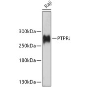 Western blot analysis of extracts of Raji cells using PTPRJ Antibody (1/1000 dilution).