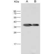 Western blot analysis of recombinant DENV-2 (strain New Guinea C) NS5 (methyltransferase domain) / Nonstructural protein 5 Protein (5 ng and 1 ng), using DENV-2 NS5 methyltransferase domain Antibody (1/10000 dilution).