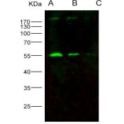 Western blot analysis of recombinant HIV-p51 / RT-p51 (group M, subtype B, isolate HXB2) Gag-Pol polyprotein Protein (20 ng, 5 ng and 1 ng), using HIV-1 RT-p51 Antibody (1/1000 dilution).