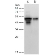 Western blot analysis of recombinant SARS-CoV Nucleoprotein (30 ng and 5 ng), using SARS-CoV Nucleoprotein Antibody (1/2000 dilution).