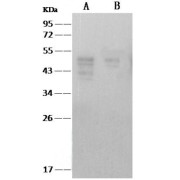 Western blot analysis of recombinant SARS-CoV Nucleoprotein (50 ng and 15 ng), using SARS-CoV Nucleoprotein Antibody (1/2000 dilution).