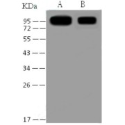 Western blot analysis of recombinant SARS-CoV S1 Protein (30 ng and 5 ng), using SARS-CoV Spike S1 Antibody (1/1000 dilution).