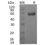 SDS-PAGE analysis of recombinant Human IL18RAP Protein.