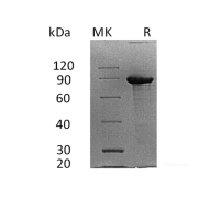 SDS-PAGE analysis of recombinant Syndecan 1 (SDC1) Protein.
