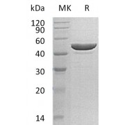 SDS-PAGE analysis of recombinant Human PRM2 protein.