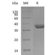 SDS-PAGE analysis of recombinant Mast Cell Tryptase (TPSAB1) Protein.