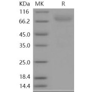 SDS-PAGE analysis of recombinant Human NRXN3 protein.