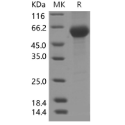 SDS-PAGE analysis of recombinant Mouse PLA2G7 Protein.