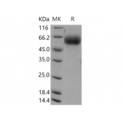 SDS-PAGE analysis of recombinant Human Adhesion Molecule With Ig Like Domain 2 (AMIGO2) Protein.