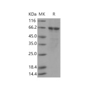 SDS-PAGE analysis of recombinant Human PLK1 Protein.