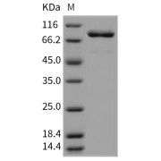 SDS-PAGE analysis of recombinant Proto-Oncogene Tyrosine-Protein Kinase Src.