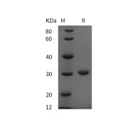 SDS-PAGE analysis of recombinant Mouse Collagen IV Alpha 1 (COL4A1) Protein.