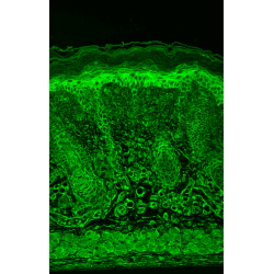 Hypoxia-Inducible Factor 1-Alpha (HIF1a) Antibody