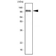 WB analysis of recombinant Human TLR7.