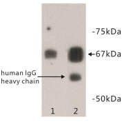 Albumin (ALB) Antibody