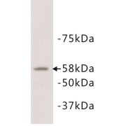 Alkaline Phosphatase, Placental (ALPP) Antibody