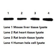 Beta Actin (ACTB) Antibody