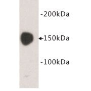 Carcinoembryonic Antigen-Related Cell Adhesion Molecule 5 (CEACAM5) Antibody