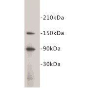 Hematopoietic Progenitor Cell Antigen CD34 (CD34) Antibody