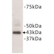 CD9 Antigen (CD9) Antibody