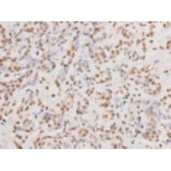 DNA-Dependent Protein Kinase Catalytic Subunit (PRKDC) Antibody