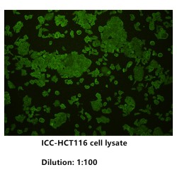 Epithelial Cadherin (CDHE) Antibody