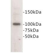 Epithelial Cadherin (CDHE) Antibody