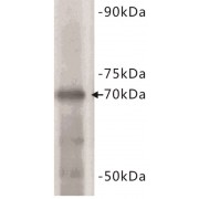 Estrogen Receptor 1 (ESR1) Antibody
