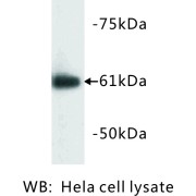 Heat Shock 60 kDa Protein 1, Chaperonin / HSP60 (HSPD1) Antibody