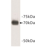 Human Serum Albumin (ALB) Antibody