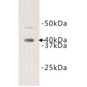 Interleukin 1 Receptor Like Protein 1 (IL1RL1) Antibody