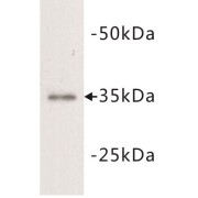 L-Lactate Dehydrogenase A Chain (LDH-A) Antibody