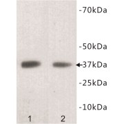 L-Lactate Dehydrogenase B Chain (LDH-B) Antibody