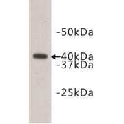 Ceramide synthase 2 (CERS2) (CERS2) Antibody