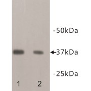 Homeobox Protein NANOG (NANOG) Antibody