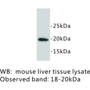 SCA1 Antibody