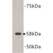 Terminal Deoxyribonucleotidyltransferase (DNTT) Antibody