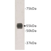 Transmembrane Protein 132A (TMEM132A) Antibody