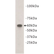 Transmembrane Protein 132E (TMEM132E) Antibody