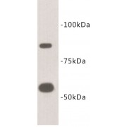 Cell Surface Hyaluronidase (CEMIP2) Antibody