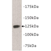 Tyrosine-Protein Kinase Receptor Tie-1 (TIE1) Antibody