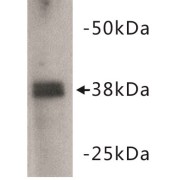 Zinc Finger Protein 42 (ZFP-42) Antibody