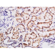 IHC-P analysis of human kidney tissue.